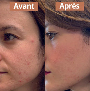 avant apres routine imperfection comme avant