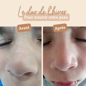 crème au beurre de karité comme avant pour nourrir la peau en hiver