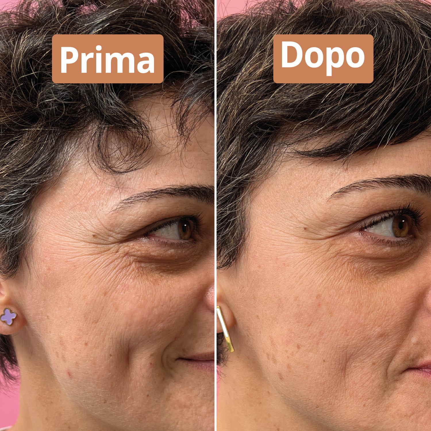 Risultati siero anti-età Comme Avant