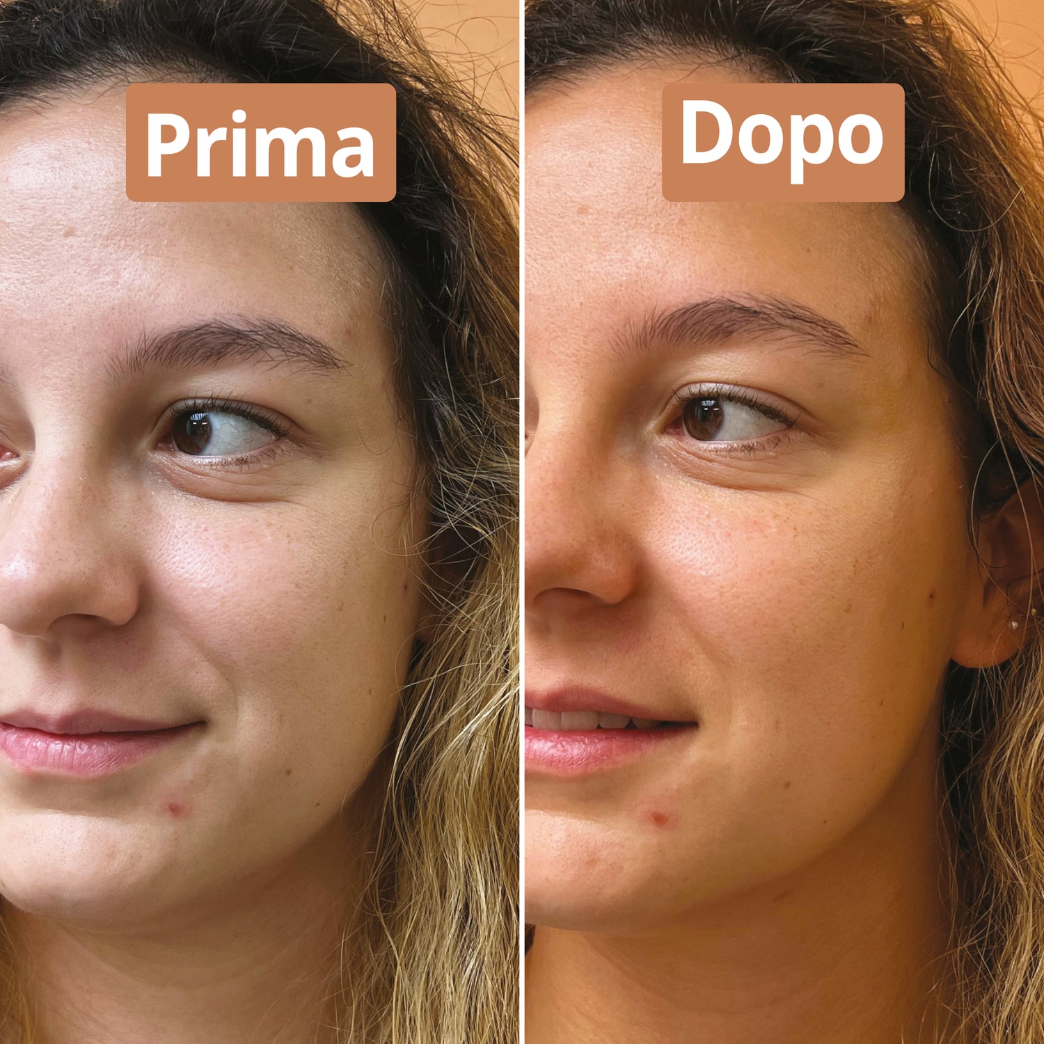 Risultati siero pelle radiosa Comme Avant