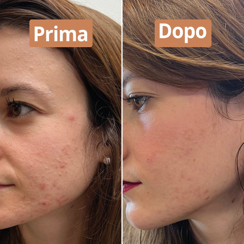 Risultato siero anti-imperfezioni Comme Avant