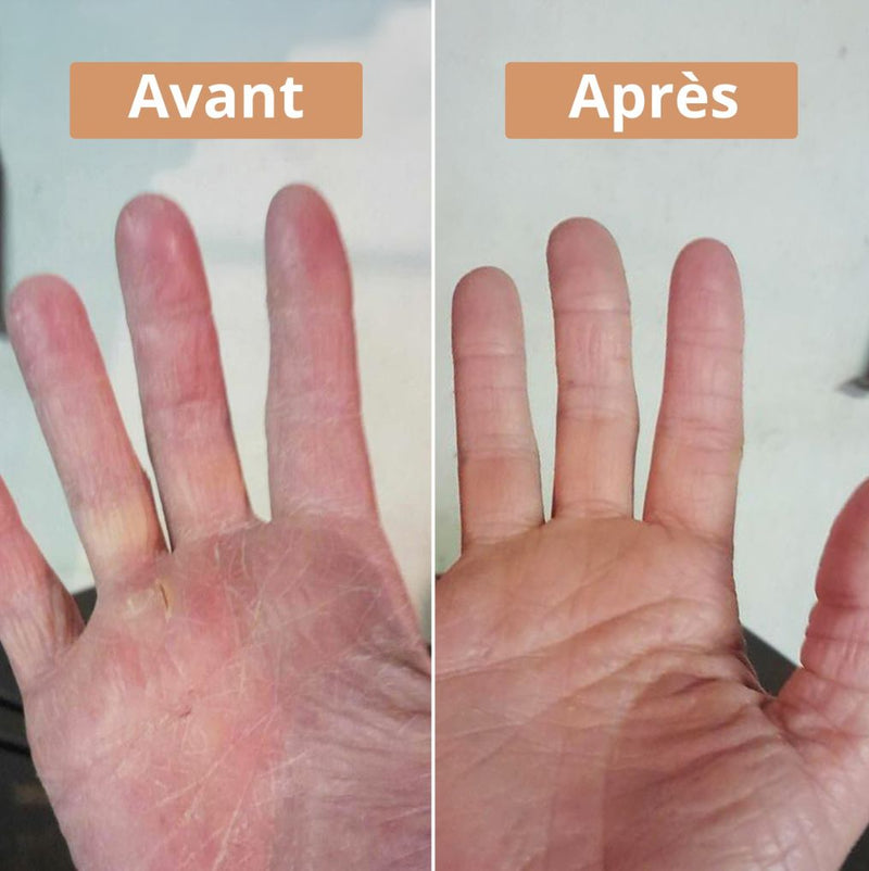 Avant et après utilisation de la crème au beurre de karité