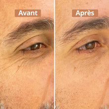 avant après sérum contour des yeux 