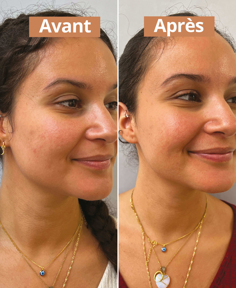 avant après sérum hydratant comme avant 