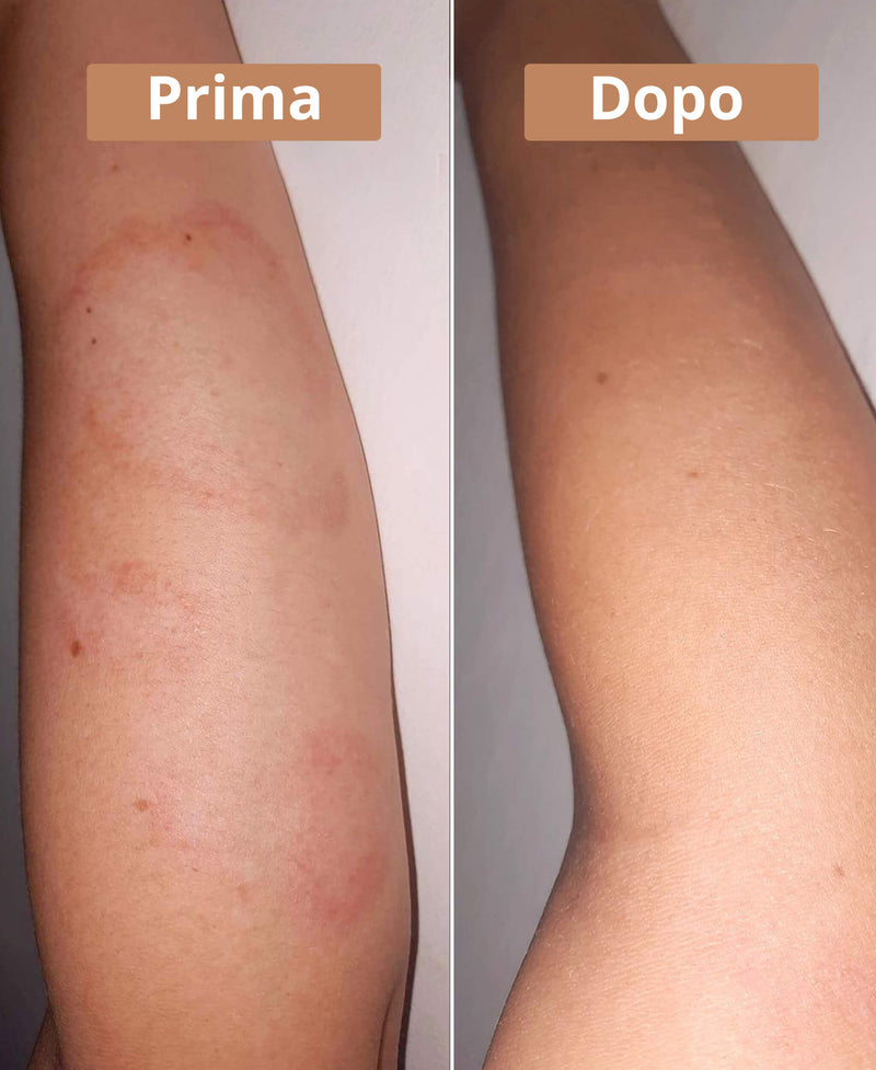 prima e dopo la crema al burro di karité Comme Avant