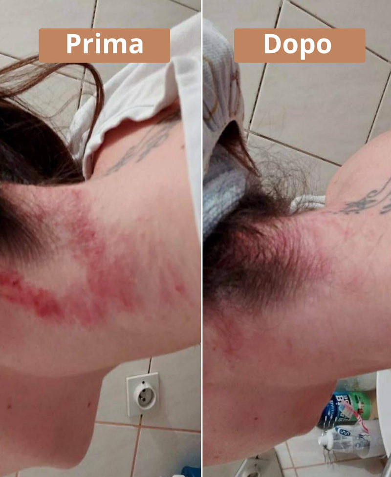 prima e dopo la crema al burro di karité Comme Avant