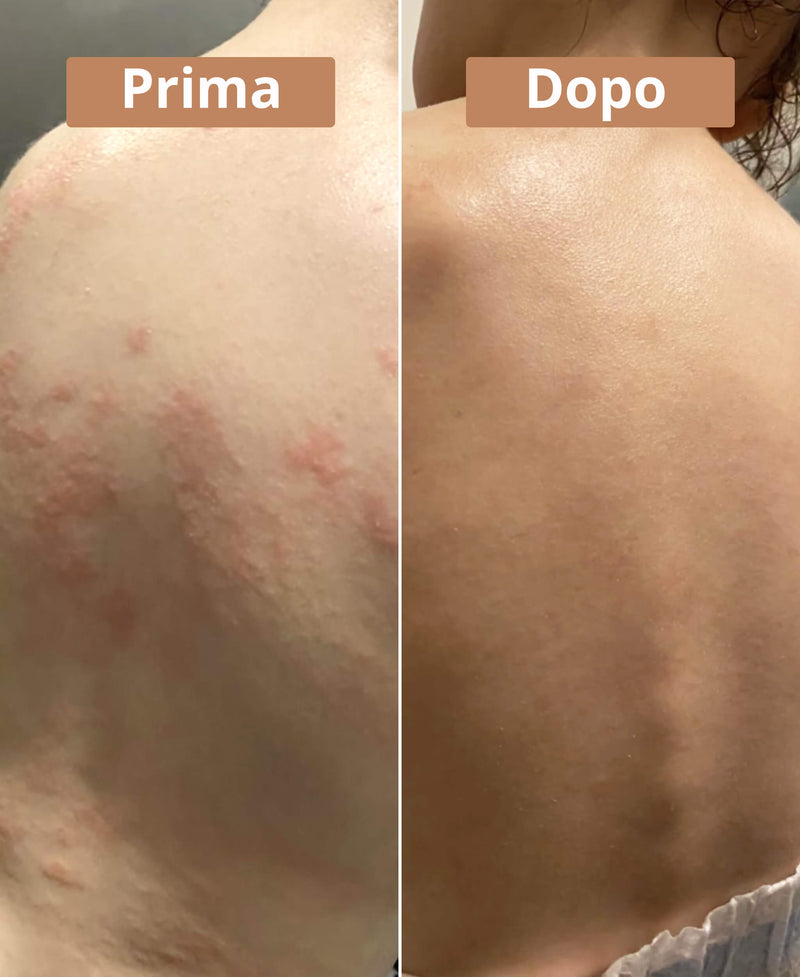 prima e dopo la crema al burro di karité Comme Avant