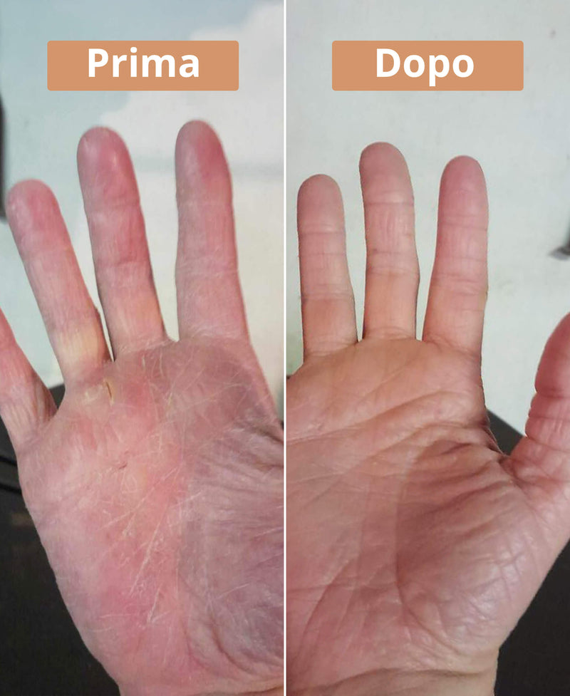 prima e dopo la crema al burro di karité Comme Avant