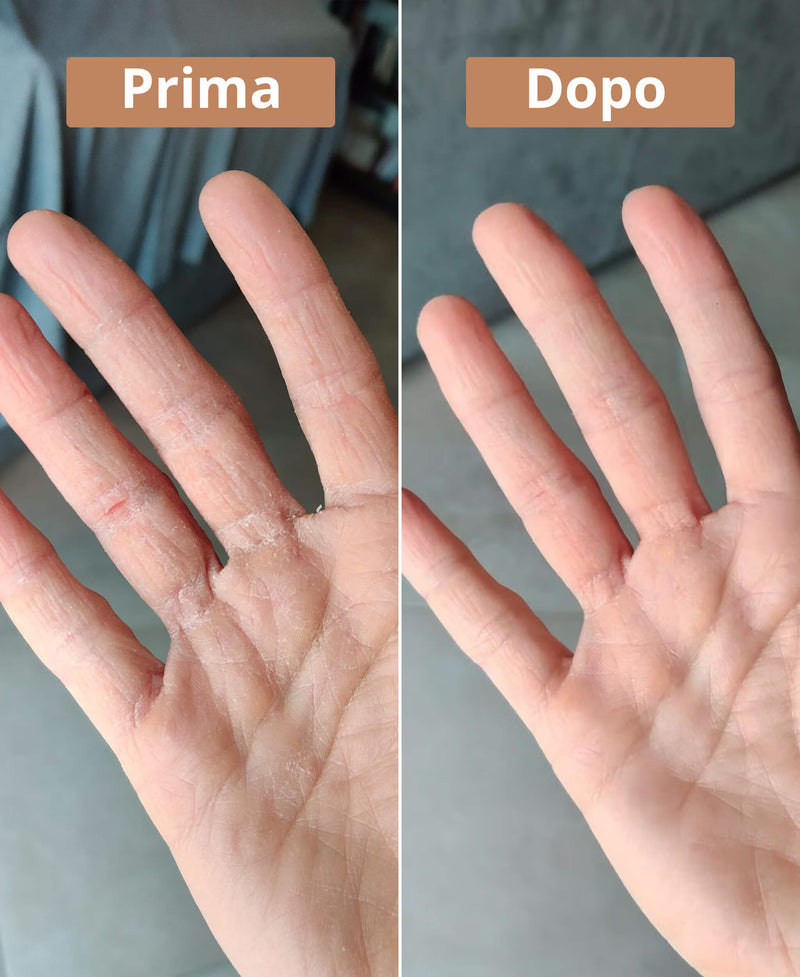 prima e dopo la crema al burro di karité Comme Avant
