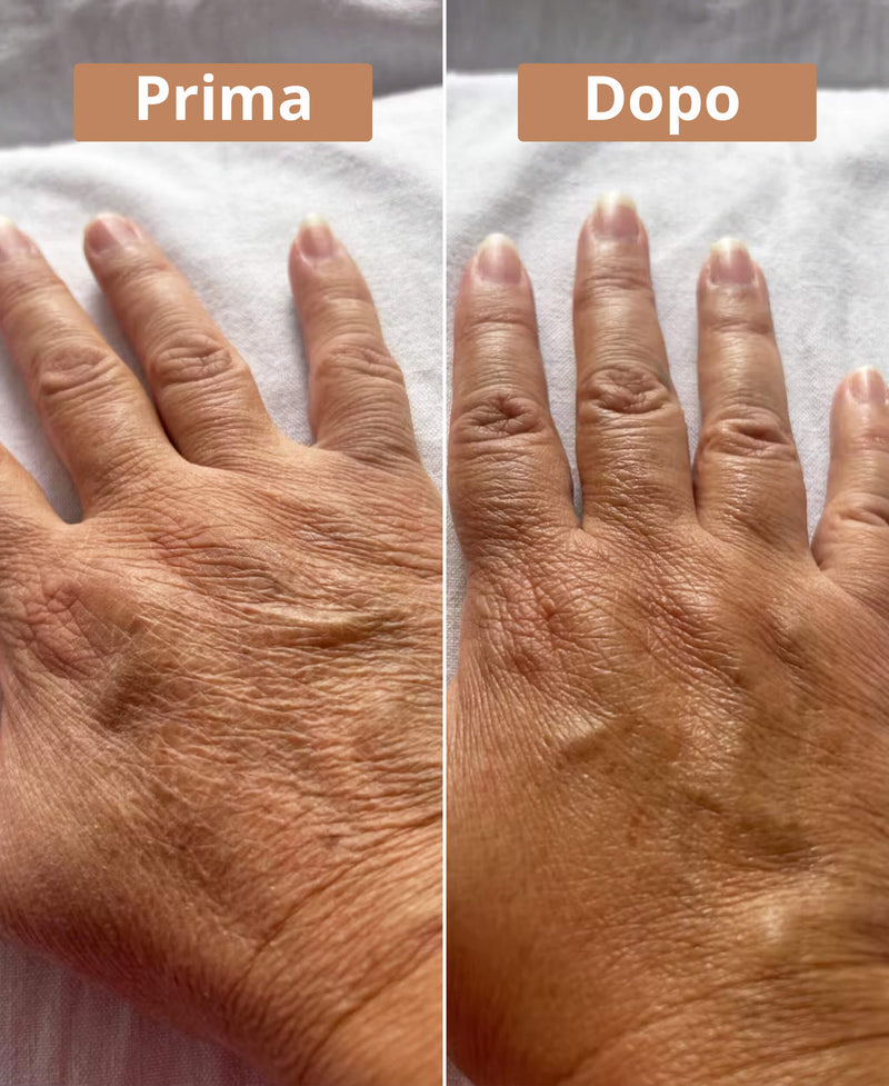 prima e dopo la crema al burro di karité Comme Avant
