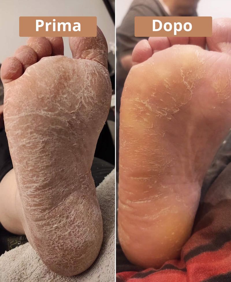 prima e dopo la crema al burro di karité Comme Avant