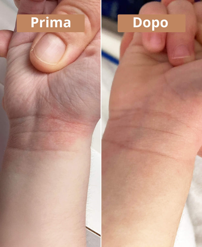 prima e dopo la crema al burro di karité Comme Avant