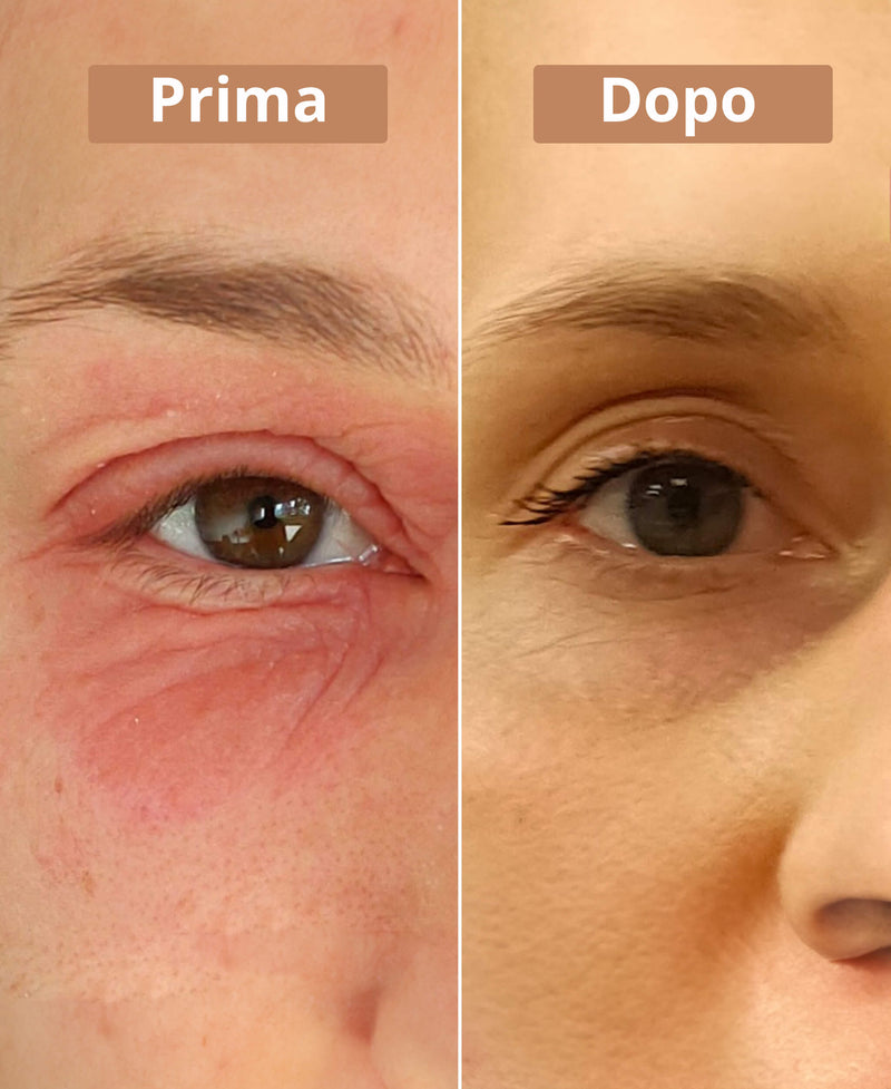 prima e dopo la crema al burro di karité Comme Avant
