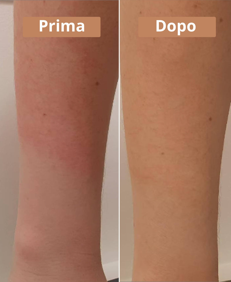 prima e dopo il sapone all'olio di borragine Comme Avant