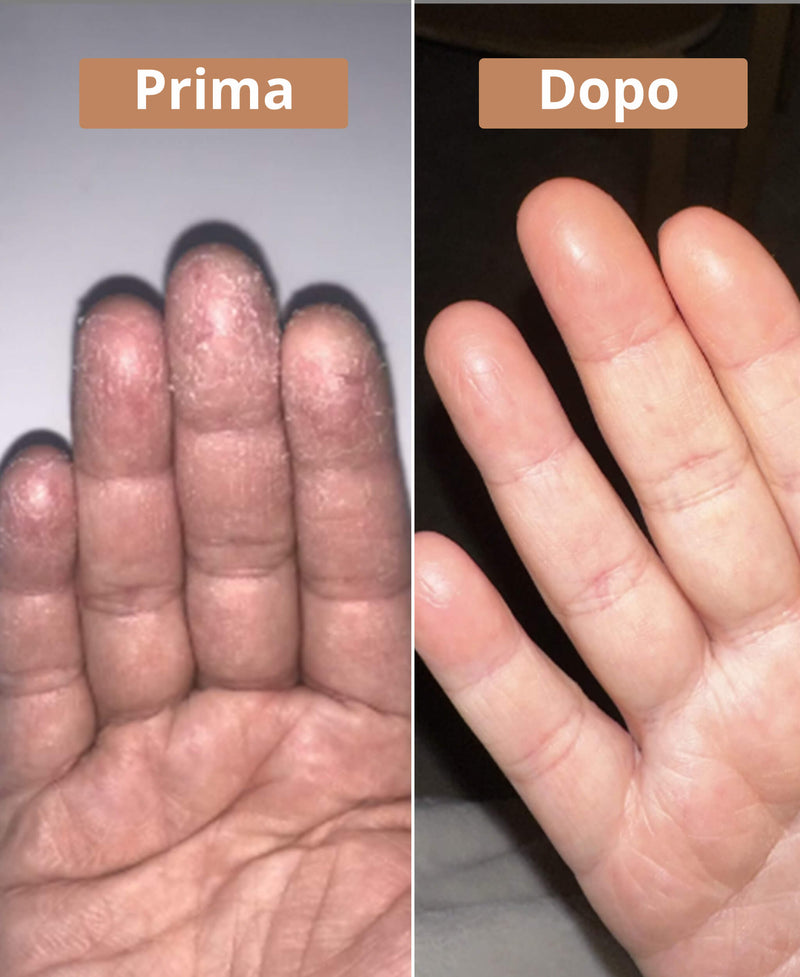 prima e dopo il sapone all'olio di borragine Come Avant