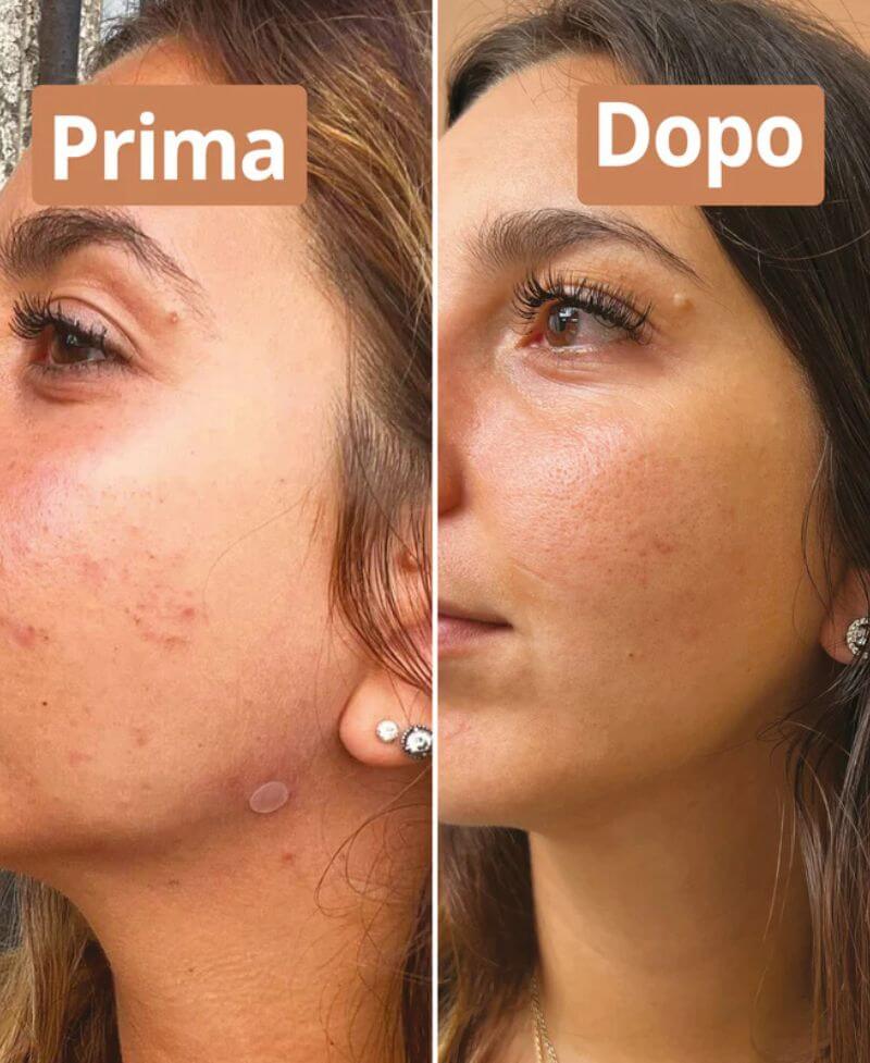 Prima e dopo l'utilizzo del sapone alle bacche di alloro di Comme Avant