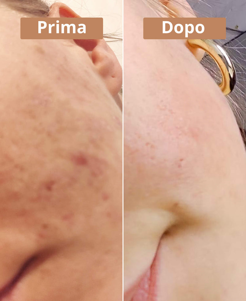prima e dopo il sapone all'olio di bacche di alloro di Comme Avant