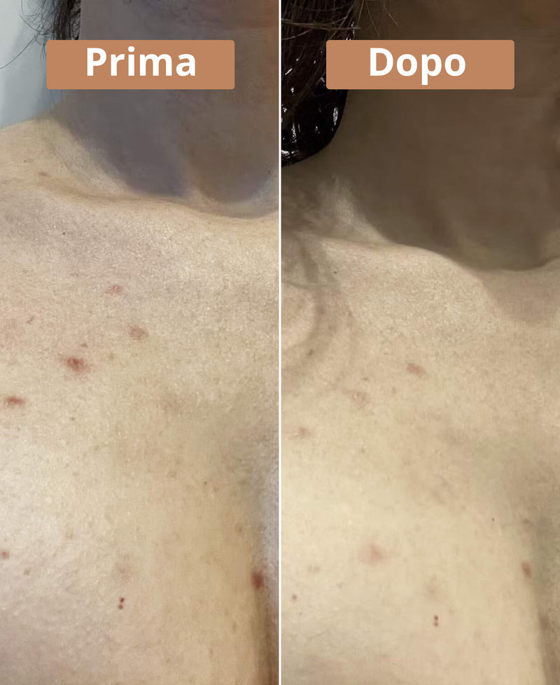 prima e dopo il sapone all'olio di bacche di alloro Come Avant