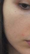 Siero viso purificante e anti imperfezioni