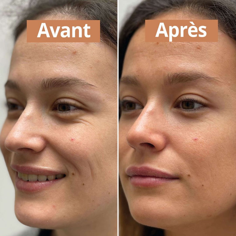 serum autobronzant avant après 
comme avant